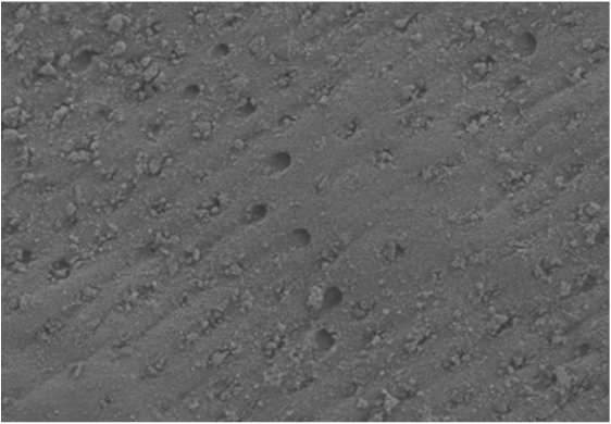 90,79% Dentin tertutup