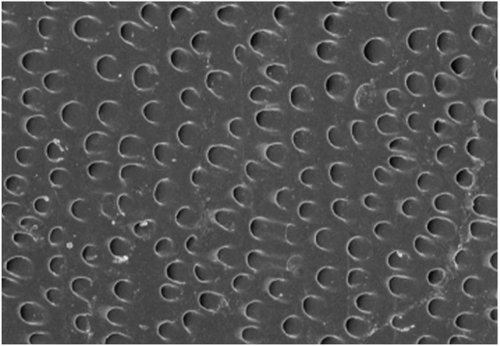 Saluran dentin terbuka