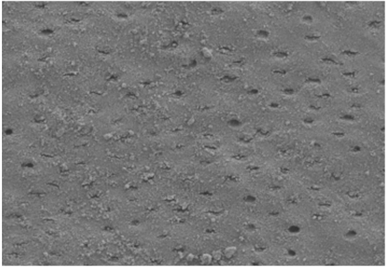 64,87% Dentin tertutup