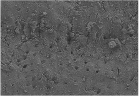 79,34% Dentin tertutup